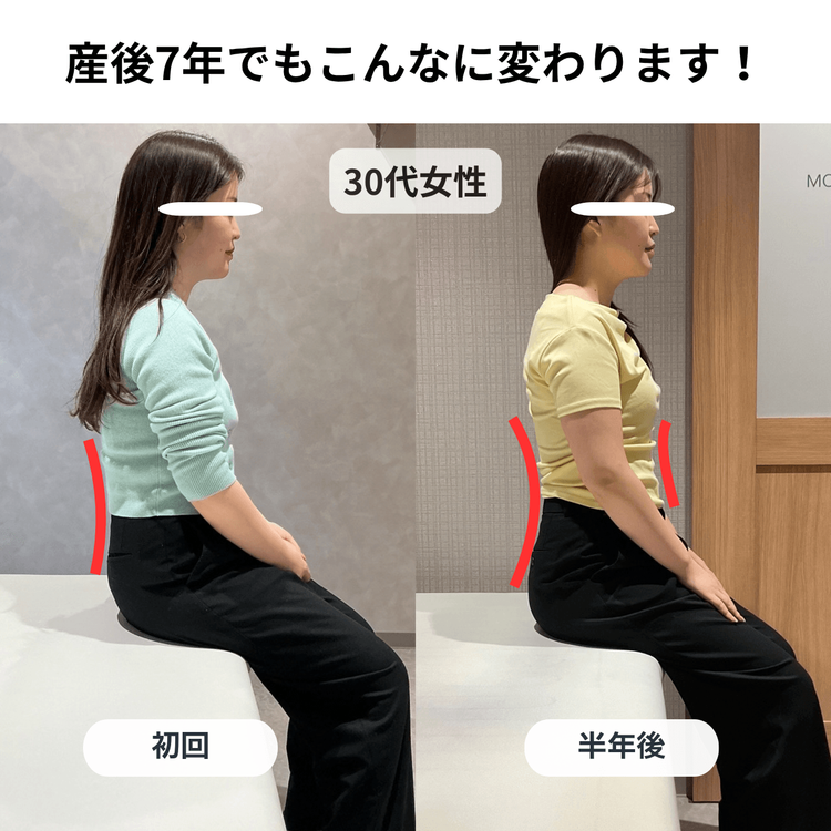 産後7年でも遅くない！姿勢と体型の変化をご紹介♪の施術前と施術後の比較
