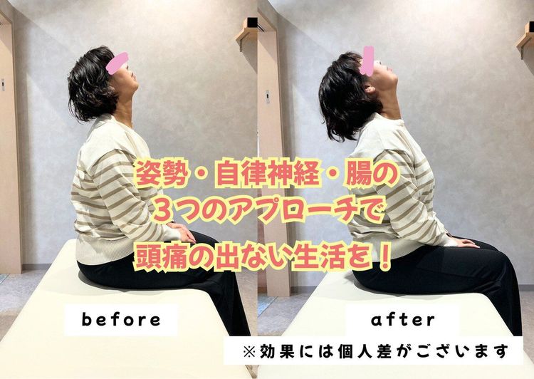 40代以降の頭痛そろそろ解決しませんか??