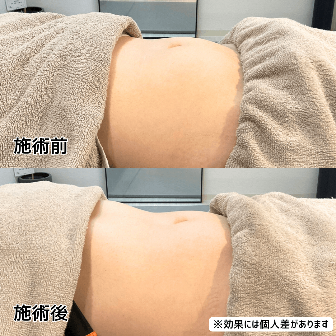 驚異の-12㎏成功! (28).png